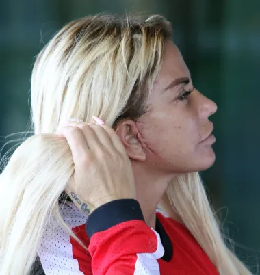 Danas se čak i plastični kirurzi slažu kako je Katie Price primjer žene koje je prema svim mjerilima pretjerala s korekcijama. Posve si je izdeformirala i tijelo i lice te je stalno u bolovima, a neki od šavova na njezinom tijelu, prema riječima stručnjaka, neće nikad ni zacijeliti. Britanska se udruga estetskih kirurga prije nekoliko godina oglasila o njezinom slučaju te rekla kako niti jedan njezin član Katie više neće primiti kao klijenticu jer ona svojim postupcima ugrožava vlastito zdravlje. Nažalost, čini se kako sama Katie toga nije svjesna već neprekidno nastavlja utabanim putem - operaciju po operaciju do sve izobličenijeg lica. 