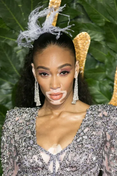 Manekenku Winnie Harlow koja ima vitiligo Tyra Banks je uočila na društvenim mrežama i izabrala ju za jednu od natjecatelja America&apos;s Next Top Modela.