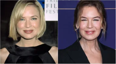 Glumica Renée Zellweger učvrstila je svoje mjesto u Hollywoodu zahvaljujući uspješnoj, desetljećima dugoj karijeri s filmovima poput &quot;Jerryja Maguirea&quot;, &quot;Dnevnika Bridget Jones&quot;, &quot;Judy&quot; i drugih. Njezina transformacija tijekom godina dovela je do nagađanja o plastičnim operacijama, iako ona sama to nikada nije priznala, već zanijekala. No, bilo da je promijenila nešto na sebi ili ne, definitivno izgleda drugačije.