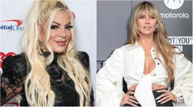 Američka glumica i spisateljica Tori Spelling prvu je plastičnu operaciju imala već sa 16 godina kako bi popravila nos, a kasnije je povećala grudi i usne. Danas se sigurno podvrgnula i botoksu i filerima, a isto je godište kao i supermodel Heidi Klum, koja i dalje izgleda prirodno. Manekenka izgleda odlično, baš kao i u mladosti, i pravi je dokaz tomu da ti ne trebaju mnogobrojne operacije kako bi dobro izgledala.