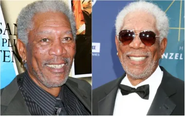 Glumac Morgan Freeman također je imao mali razmak između prednjih zuba, kao i mrlje na zubima, koje su uobičajena pojava kako ljudi stare. Prije nekoliko godina i on se odlučio za promjenu i zubi su mu postali vidljivo svjetliji i ravniji.