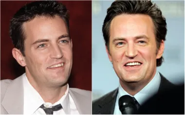 Proslavila ga je uloga Chandlera u &quot;Prijateljima&quot;, a kada smo ga gledali u seriji, i glumac Matthew Perry imao je pomalo neravne zube. Ipak, i on ih je s vremenom izravnao i izbijelio.