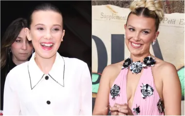Kada je bila dijete i na početku svoje glumačke karijere, Millie Bobby Brown imala je nevin, dječački osmijeh koji je otkrivao njezine simpatično neravne bijele zube. No i ona je odlučila posjetiti stomatologa i danas ima totalno drugačiji osmijeh.