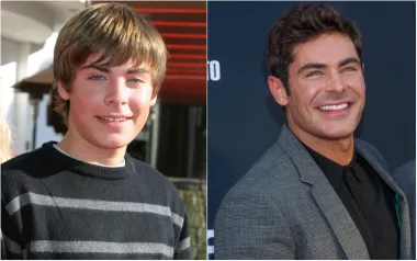 Zac Efron prešao je dug put od uloge u Disneyjevom &quot;High School Musicalu&quot; do uloge serijskog ubojice Teda Bundyja, a i njegovi zubi doživjeli su priličnu transformaciju. Kao dijete imao je razmak između dva prednja zuba, a danas ima besprijekorno ravne bijele zube.
