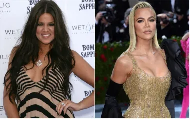 Jedna od sestara Kardashian koju su u prošlosti najviše prozivali zbog izgleda definitivno je Khloe, a itekako se promijenila u posljednjih nekoliko godina. Osim što je promijenila stil i frizuru, drastično je smršavila, a na njezinom su licu vidljivi i neki zahvati, iako je priznala da je operirala samo nos.
