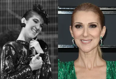 Ni kanadska glazbena diva nije se rodila sa savršenim zubima, a to jasno dokazuju i njezine fotografije iz rane mladosti. Već na samom početku karijere Celine Dion je odlučila popravili svoje zube koji danas izgledaju zaista savršeno.