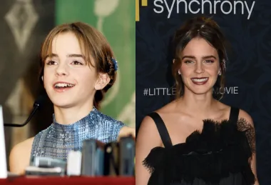 Čarima moderne estetske stomatologije nije odoljela ni zvijezda Harryja Pottera, glumica Emma Watson. U prvim nastavcima filma imala je slatki osmijeh, no kasnije je izbijelila i ispravila svoje zube i sada izgleda uistinu fantastično.