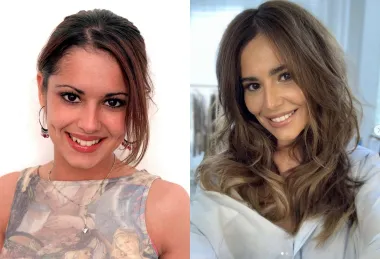 Engleska pjevačica Cheryl Tweedy oduvijek je bila ljepotica, no u mladosti je imala nepravilne zube koje je kasnije dala popraviti i izbijeliti pa danas izgleda zaista sjajno.