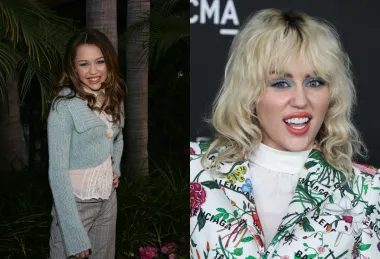 Slavna pjevačica Miley Cyrus u djetinjstvu je bila Disneyjeva zvijezda, a nakon što je napustila Disney Channel, odlučila je staviti ljuskice, što je rezultiralo apsolutno prekrasnim osmijehom.