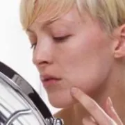 10 najčešćih uzroka pojave akni