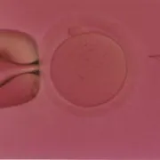 Medicinski potpomognuta oplodnja