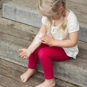 Atopijski dermatitis i njegov utjecaj na svakodnevni život