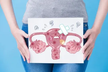 Mjesečnice znaju biti bolne, no postoji rješenje za to