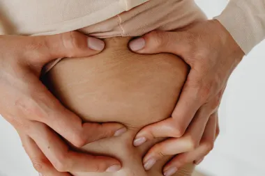 Strije - neželjene šare na koži koje uz nekoliko trikova možeš umanjiti