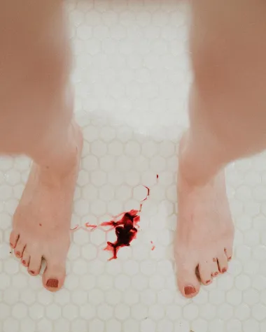 Krvni ugrušci kod menstruacije: Opasno stanje koje žene zanemaruju