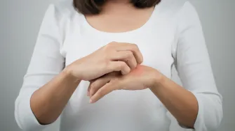 Atopijski dermatitis: Sve što trebaš znati o ovoj kožnoj bolesti