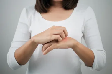 Atopijski dermatitis: Sve što trebaš znati o ovoj kožnoj bolesti