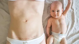 Strah i sreća: Dirljive ispovijesti 5 mama koje su rodile carskim rezom