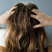 Od peruti do psorijaze: 6 'krivaca' koji se kriju iza svrbeža vlasišta