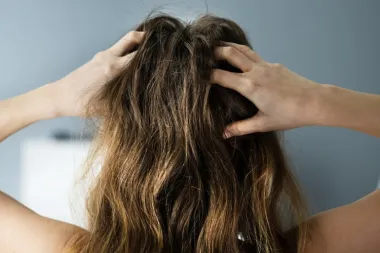 Od peruti do psorijaze: 6 'krivaca' koji se kriju iza svrbeža vlasišta