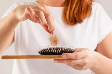 Gubitak kose u menopauzi: Je li trajan i može li se spriječiti?
