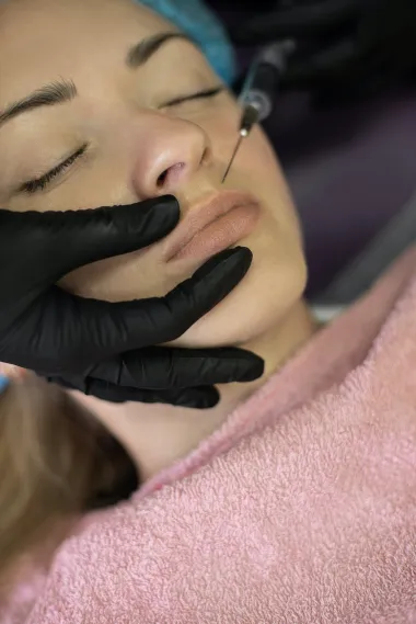 Fileri: 8 stvari koje trebaš znati o jednom od najpopularnijih estetskih tretmana
