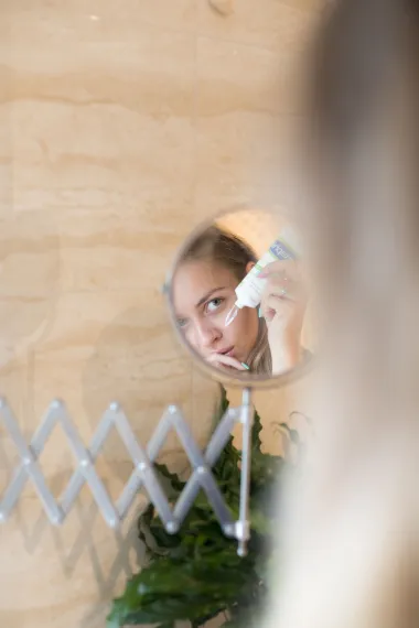 Problem za mnoge: Što uzrokuje akne u odrasloj dobi?