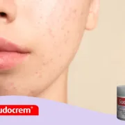Sudocrem® – tvoja mala tajna besprijekorne kože!