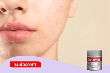 Sudocrem® – tvoja mala tajna besprijekorne kože!
