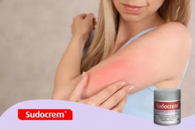 Sudocrem® – tvoja mala tajna besprijekorne kože!